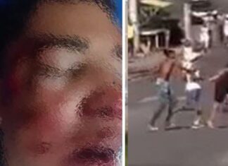 VÍDEO: Homem fica com rosto desconfigurado após ser agredido por torcedores do Bahia
