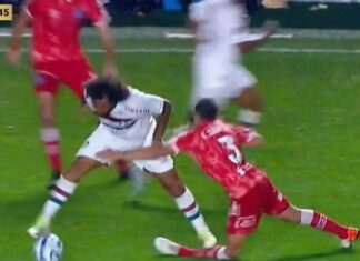 Veja como ficou o joelho do jogador argentino lesionado em lance com brasileiro