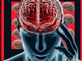 Aneurismas podem ser silenciosos e provocar morte