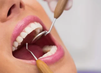 Altas taxas de cárie, tártaro e gengivite entre brasileiros preocupam especialistas e acendem alerta para a importância da prevenção