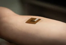 Câncer de pele: adesivo promete identificar risco da doença