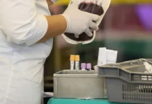 Alerta de saúde pública: doença falciforme afeta até 100 mil brasileiros; veja sintomas